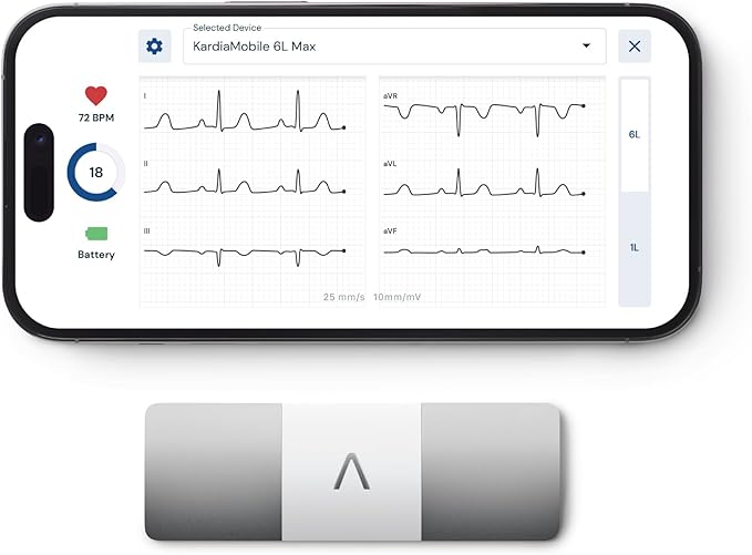 KardiaMobile 6L Max with 12-Month Subscription | 6-Lead Personal EKG Monitor | Heart Health Membership | Detects AFib & Irregular Arrhythmias | Easy Results in 30 Seconds | Works with Smartphones