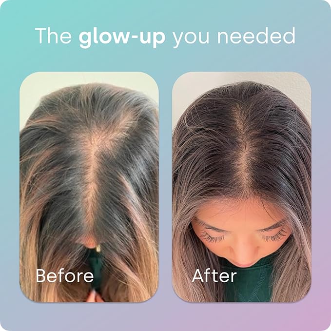 Biosil Advanced Hair + Nail Care - Growth Vitamins for Women - Strengthen & Thicken Strands - 30 Capsules - Patented ch-OSA - 15-Day Supply